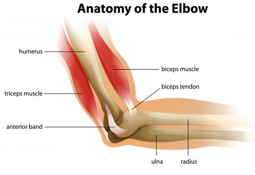 The biceps brachii is a muscle located in the upper arm that flexes the elbow joint during a various types of arm curls.