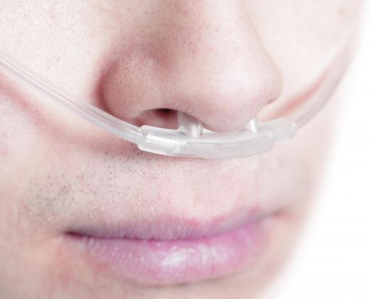 Nasal cannulas are used at oxygen bars.