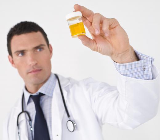 Athletes may take diuretics to try to beat a urinalysis for banned substances.
