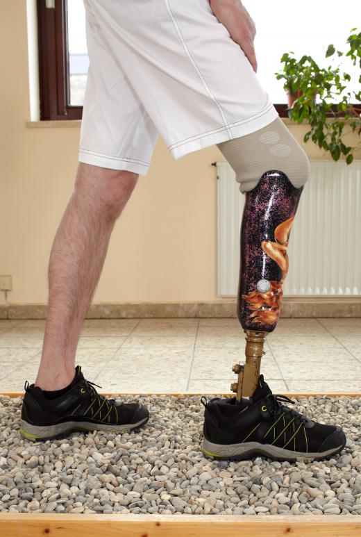 Sports biomechanics may include helping an amputee find the most effective and efficient prosthetic.